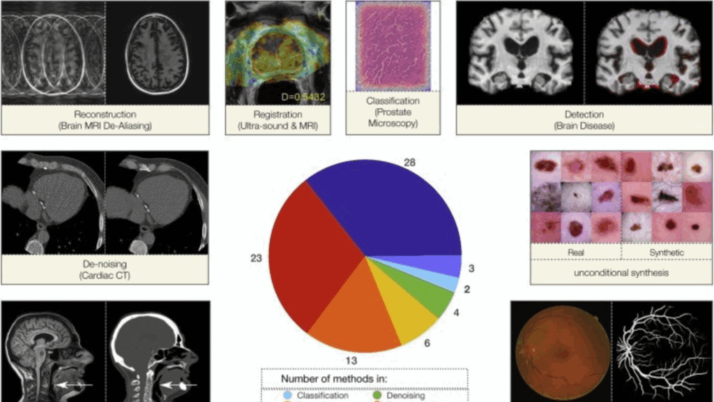 A complex infographic showcasing various AI applications in medical imaging and diagnostics, including reconstruction, registration, classification, detection, denoising, and synthetic data generation, with a pie chart.